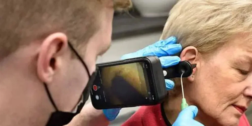 Earwax Removal Service